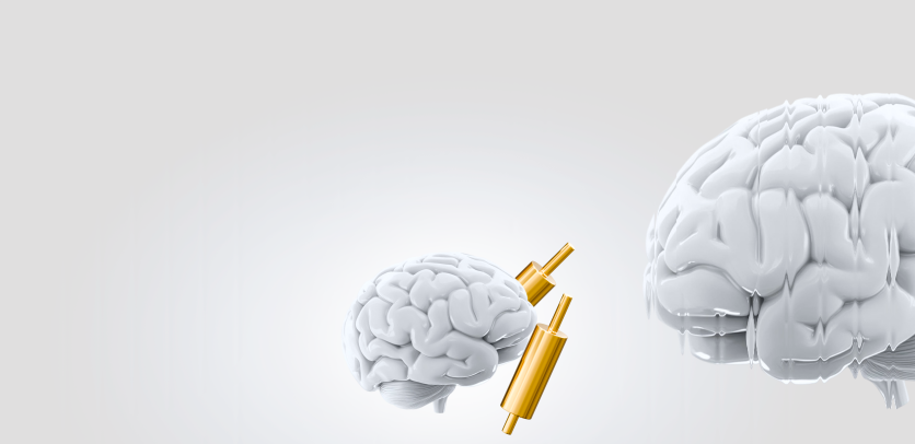 ¿Qué es la psicología de trading a prueba de pérdidas?